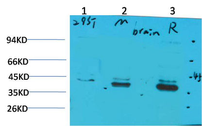 CABP2 Rabbit Polyclonal Antibody (A190)