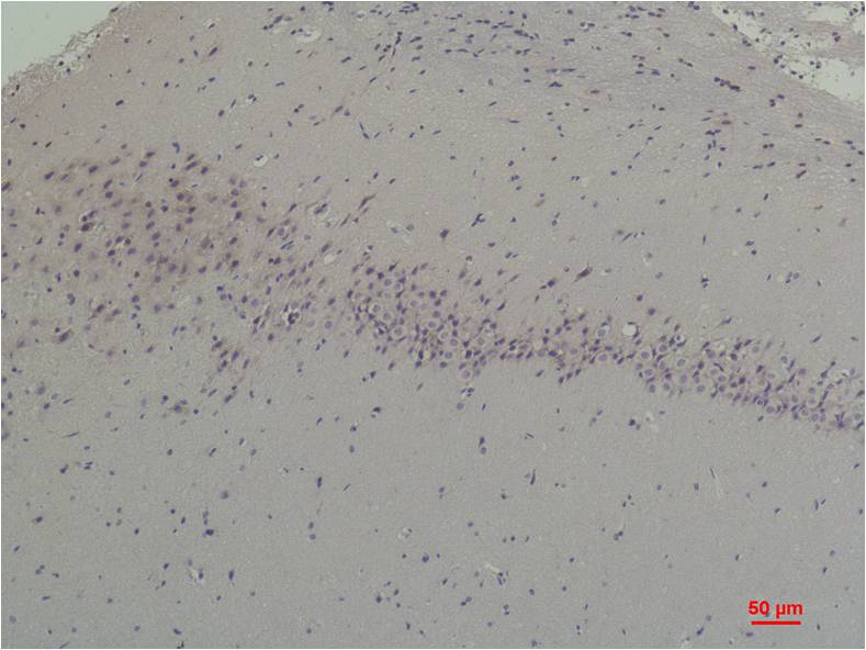 CABP2 Rabbit Polyclonal Antibody (A190)