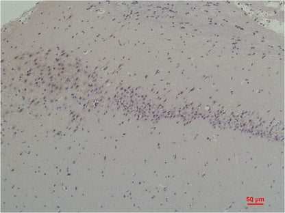 CABP2 Rabbit Polyclonal Antibody (A190)