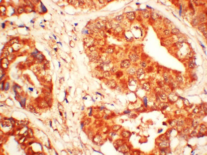 XIAP Rabbit Polyclonal Antibody