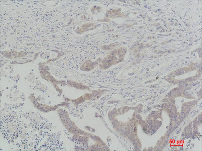 c-Raf Rabbit Polyclonal Antibody (F275)