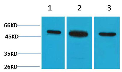 Beta II Tubulin Rabbit Polyclonal Antibody
