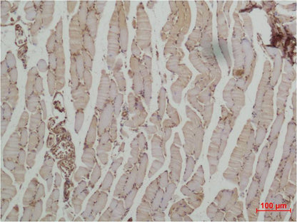 Beta II Tubulin Rabbit Polyclonal Antibody