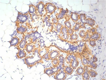 Beta-actin Rabbit Polyclonal Antibody