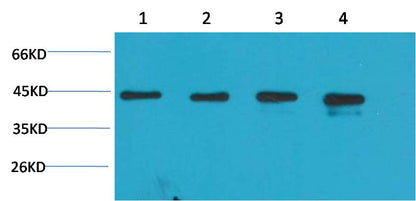 Beta-actin Rabbit Polyclonal Antibody (A284)