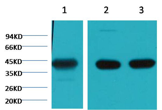 Alpha skeletal muscle actin Monoclonal Antibody (4B11)
