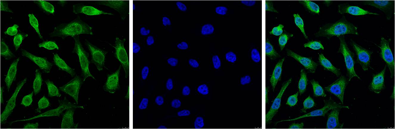 Progesterone Receptor Monoclonal Antibody (Z15)