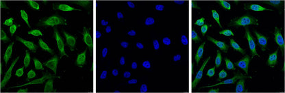 Progesterone Receptor Monoclonal Antibody (Z15)