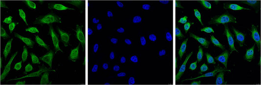 Progesterone Receptor Monoclonal Antibody (Z15)