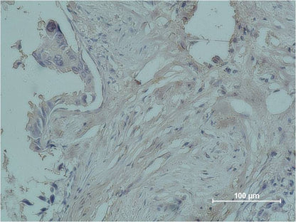 Progesterone Receptor Monoclonal Antibody (Z15)