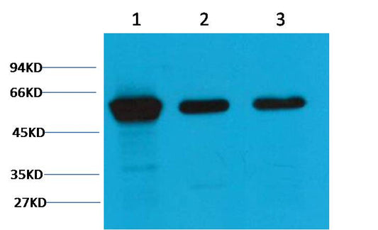 Vimentin Monoclonal Antibody (1A7)