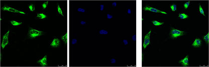 Vimentin Monoclonal Antibody (1A7)