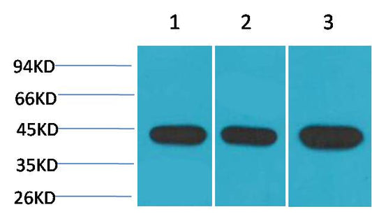 Alpha-Smooth Muscle Actin Monoclonal Antibody (1E12)