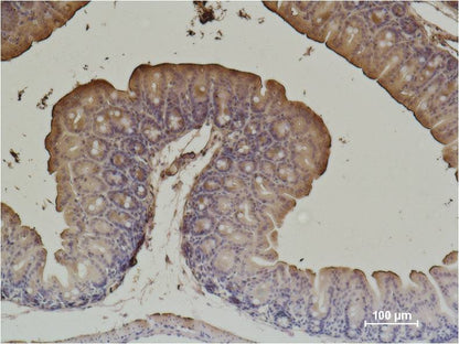 Alpha-Smooth Muscle Actin Monoclonal Antibody (6A12)