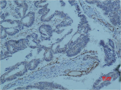 Survivin Monoclonal Antibody (Mix-mA)