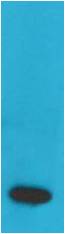 TNF Alpha Monoclonal Antibody (Q34)