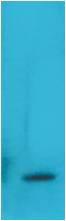 TNF Alpha Monoclonal Antibody (Q36)