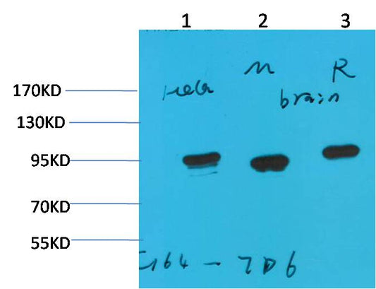HSP90 Alpha Monoclonal Antibody (7D6)