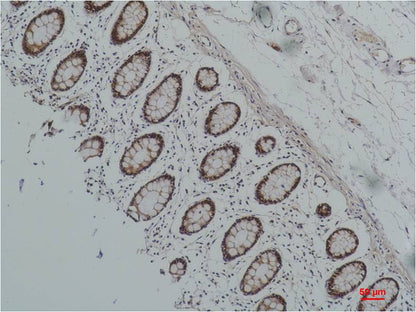 HSP90 Alpha Monoclonal Antibody (7D6)
