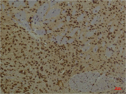 PI3 Kinase P85Alpha Monoclonal Antibody (3B7)