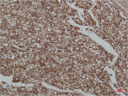 Smad3 Monoclonal Antibody (8B5)
