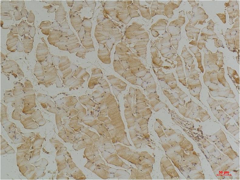 Desmin Monoclonal Antibody (1B12)