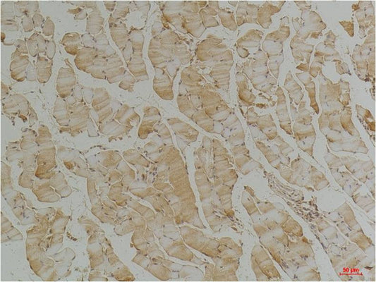 Desmin Monoclonal Antibody (1B12)