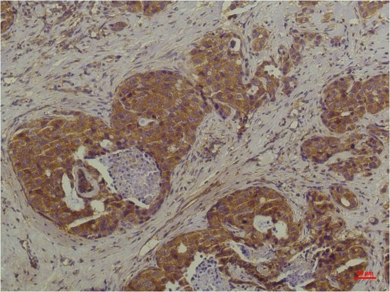 P44 42 MAPK (ERK1 2) Monoclonal Antibody (6C10)