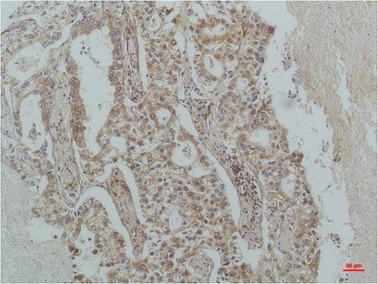 IkB Beta Monoclonal Antibody (1F3)