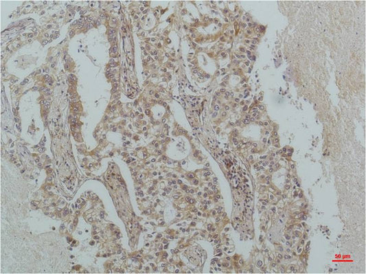 IkB Beta Monoclonal Antibody (1F3)