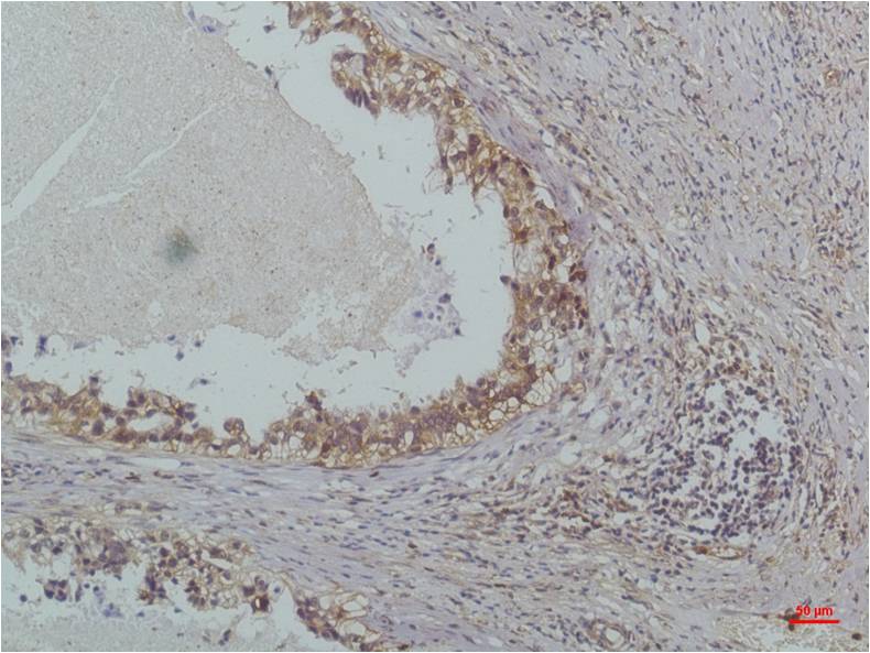 IkB Beta Monoclonal Antibody (8D11)