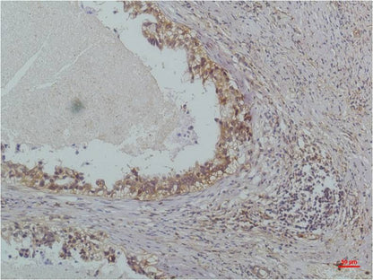 IkB Beta Monoclonal Antibody (8D11)
