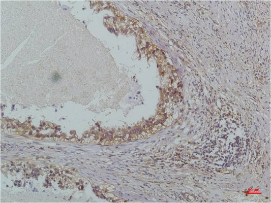 IkB Beta Monoclonal Antibody (8D11)
