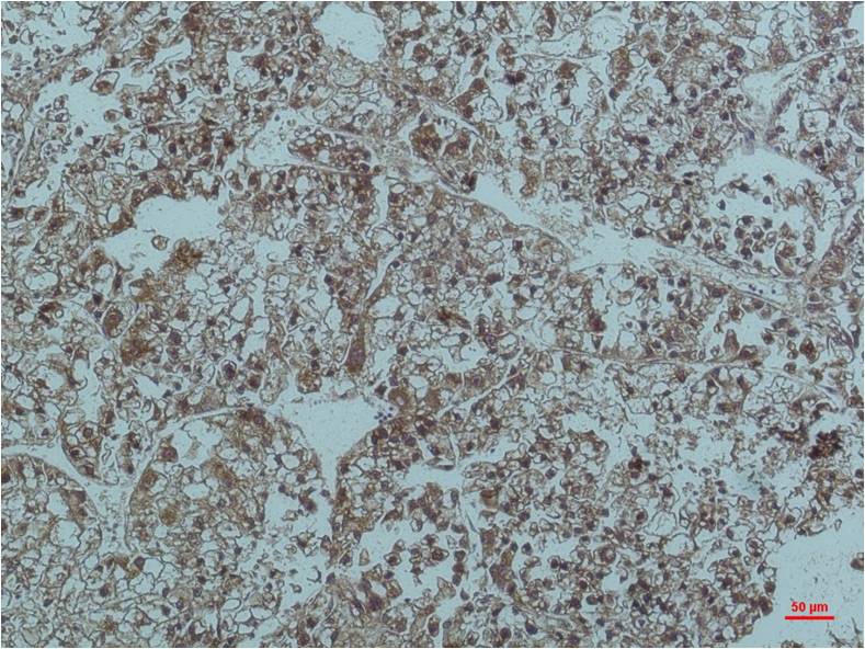 Smad3 Monoclonal Antibody (6F7)