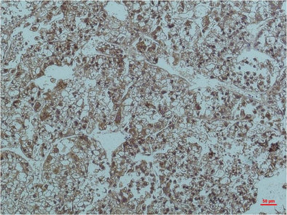 Smad3 Monoclonal Antibody (6F7)
