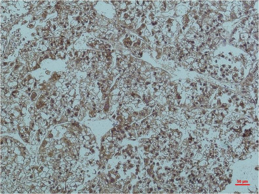 Smad3 Monoclonal Antibody (6F7)