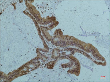 Smad3 Monoclonal Antibody (6F7)