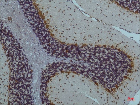 CaMKII Beta Gamma Delta (Phospho Thr287) Monoclonal Antibody (1B9)