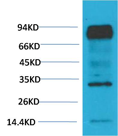 HIF-1 BetaARNT Monoclonal Antibody (4C5)