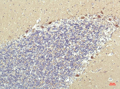 PPAR Delta Monoclonal Antibody (2F9)