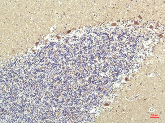 PPAR Delta Monoclonal Antibody (2F9)