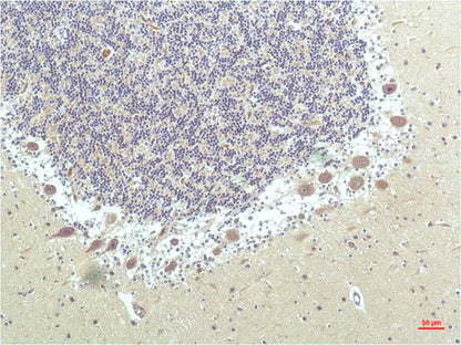 PPAR Delta Monoclonal Antibody (1D7)