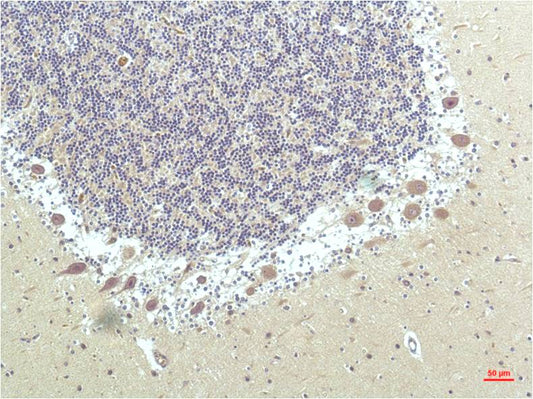 PPAR Delta Monoclonal Antibody (1D7)