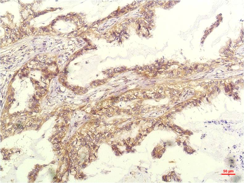 IL-8 Monoclonal Antibody (14E1)