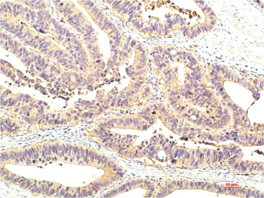 STAT1 Monoclonal Antibody (8H11)