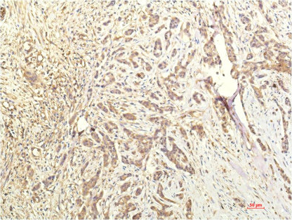 STAT1 Monoclonal Antibody (8H11)