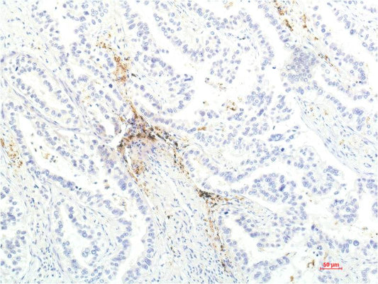 JAK1 Monoclonal Antibody (7G6)
