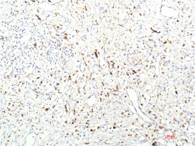 JAK1 Monoclonal Antibody (7G6)