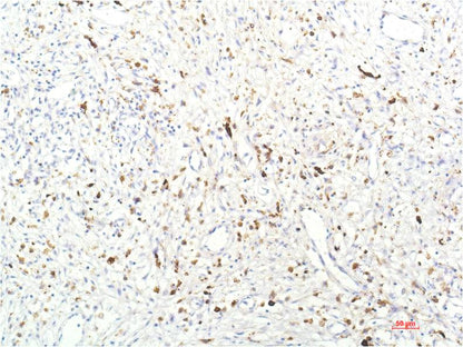 JAK1 Monoclonal Antibody (7G6)