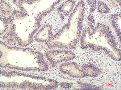 STAT1 Monoclonal Antibody (5H7)